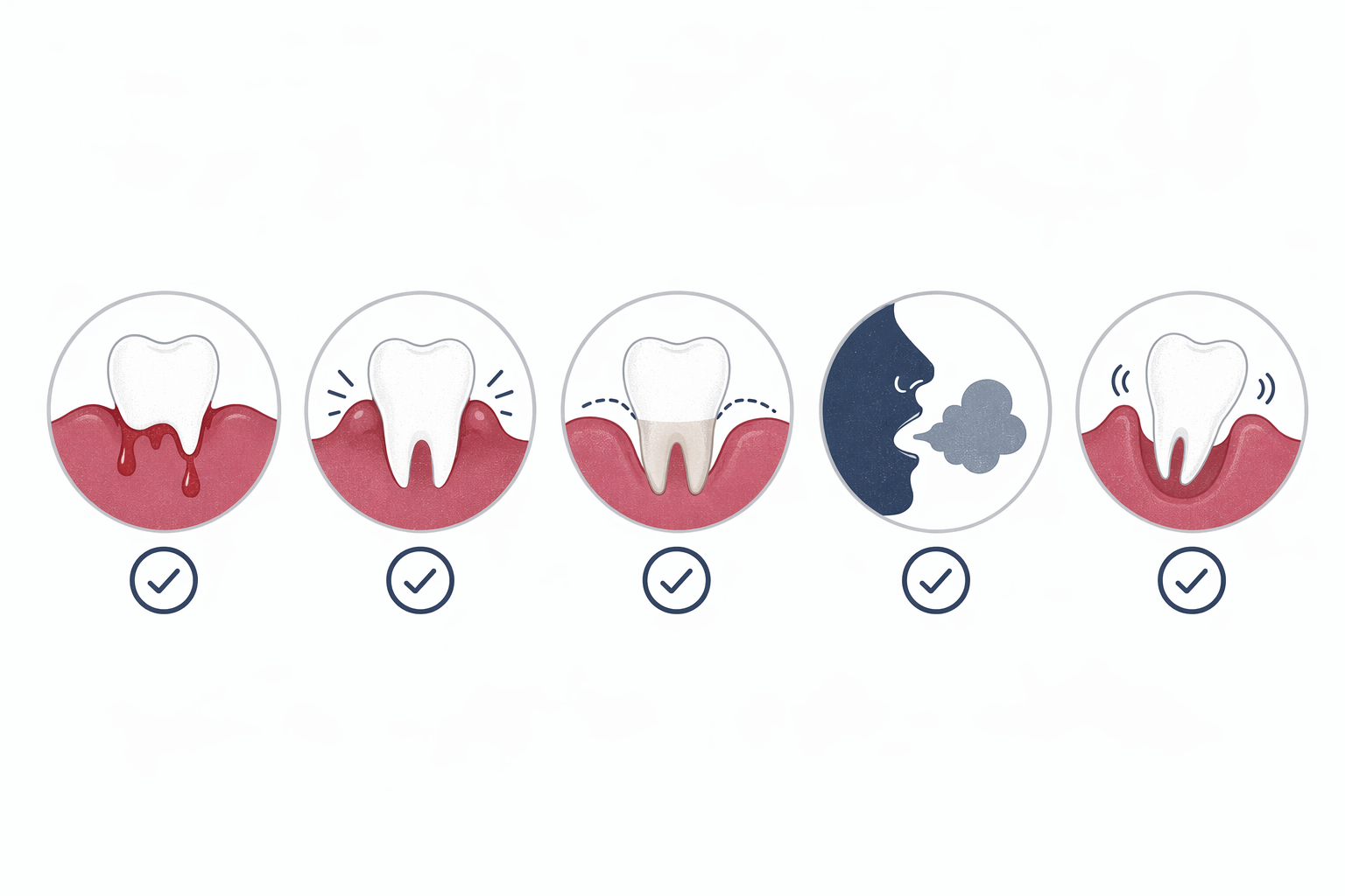 Illustration for Signs and symptoms of gum disease